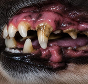 Dents qui se déchaussent